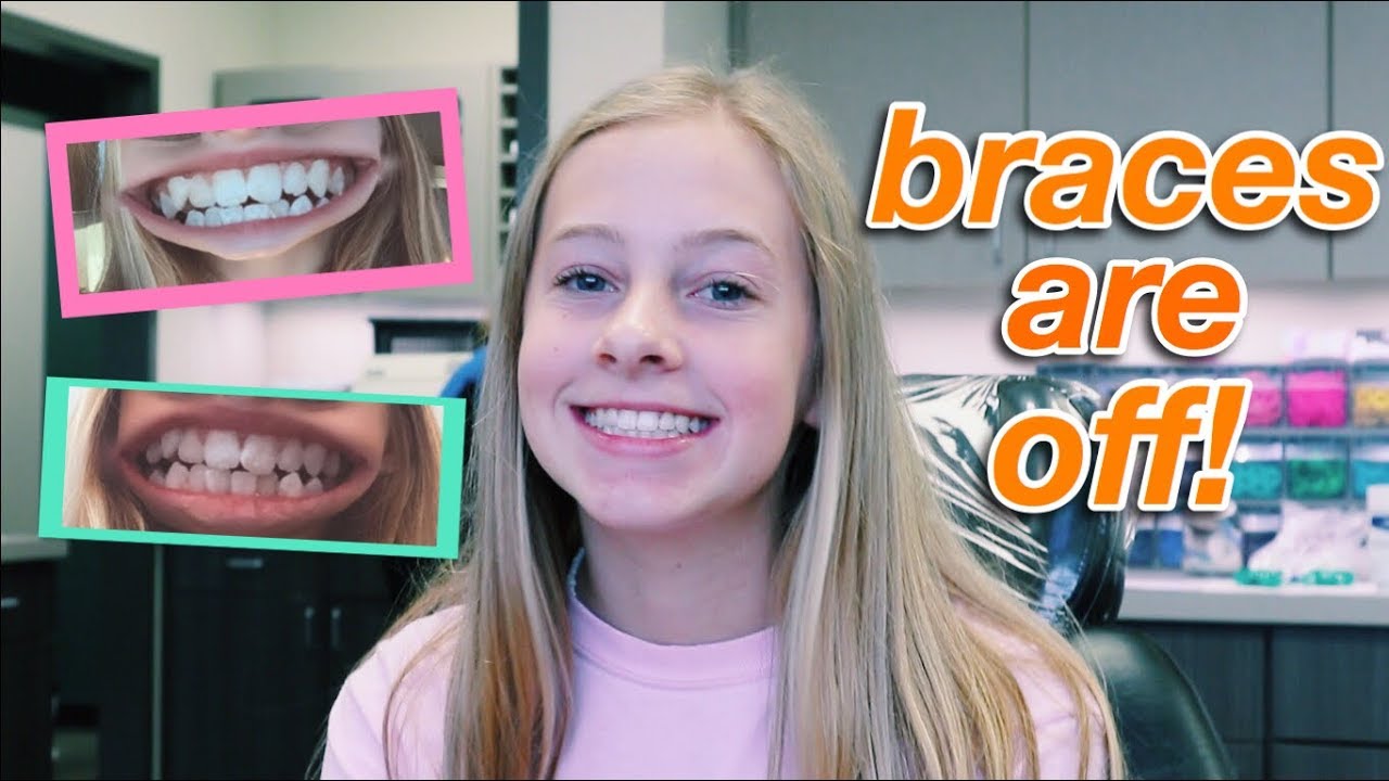 getting my braces off vlog!