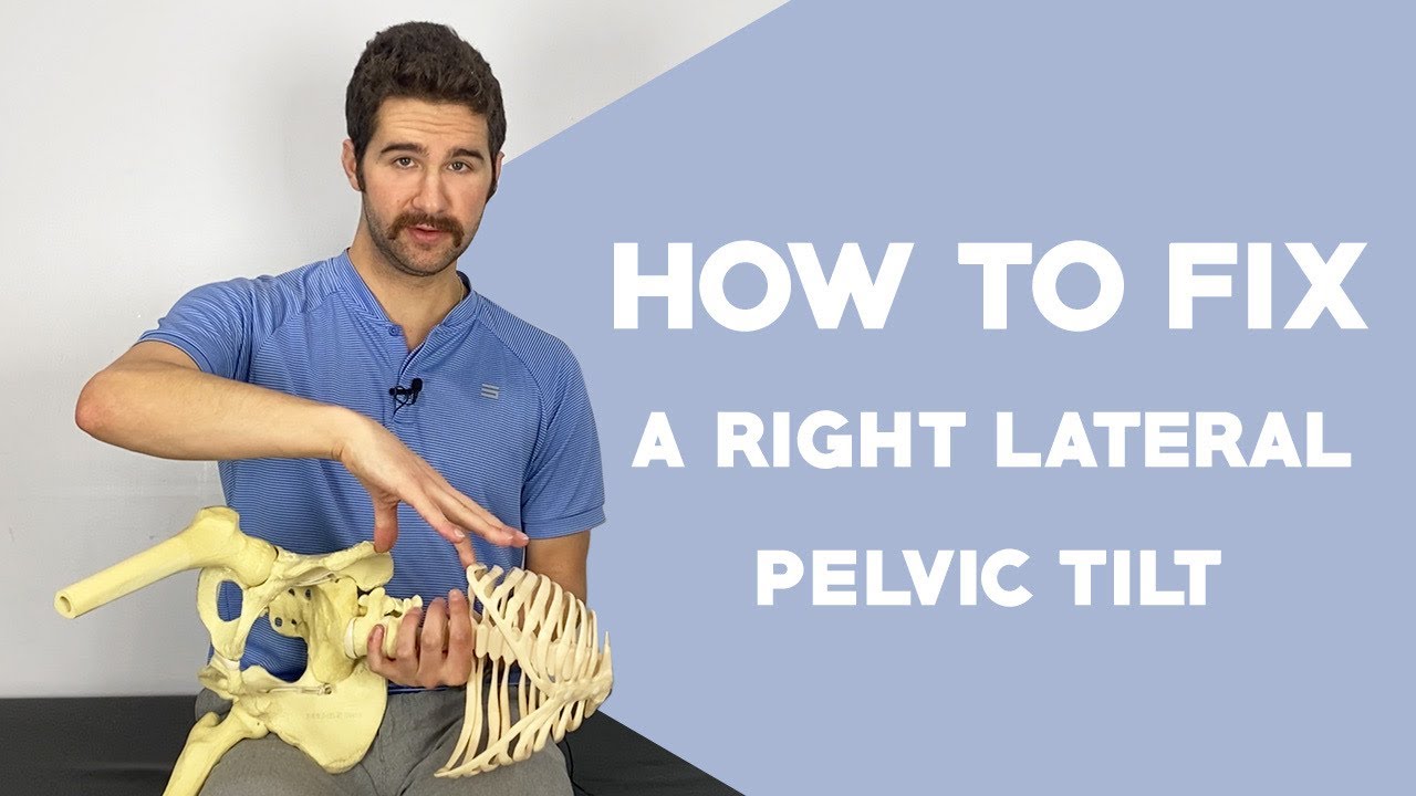 Right Lateral Pelvic Tilt Correction (EASY 5-Step Guide) (NOT the opposite of the left!)