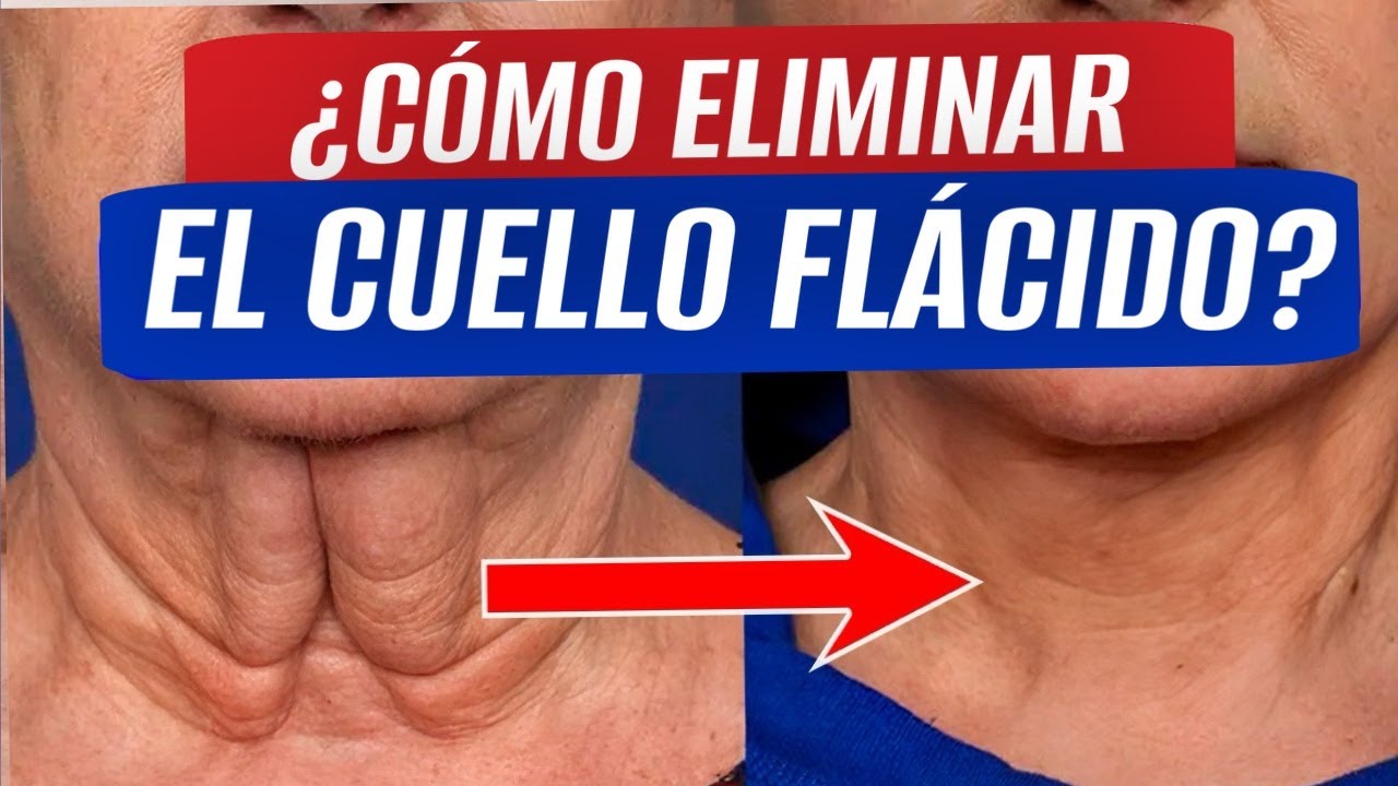 ¡Un CUELLO HERMOSO con solo 3 EJERCICIOS SIMPLES! ¿Cómo eliminar los anillos de Venus del cuello?