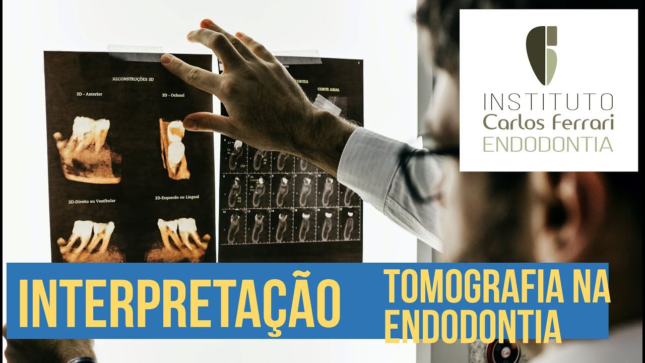 Tomografia na endodontia - 2a parte. Interpretação