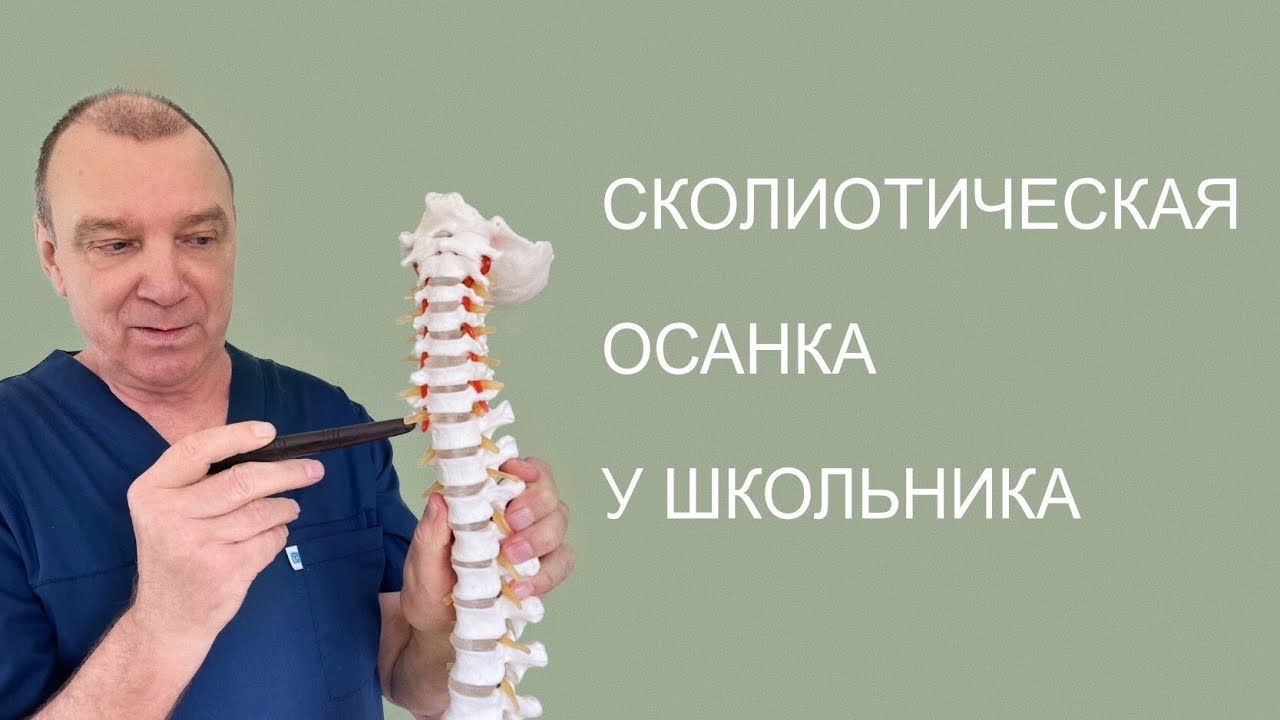 Сколиотическая осанка