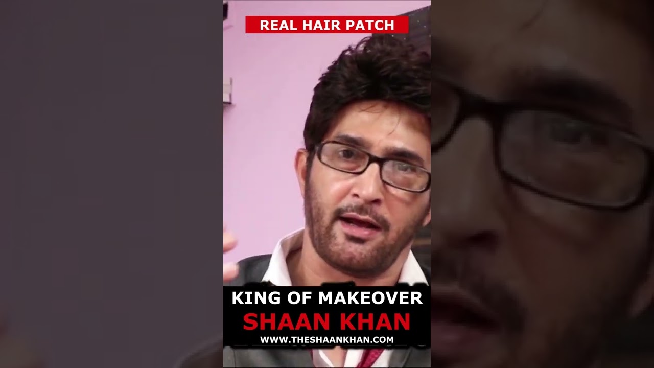 King of Real Hair Patch | Shaan Khan Hair Expert | ☎️9883359288 | Kolkata