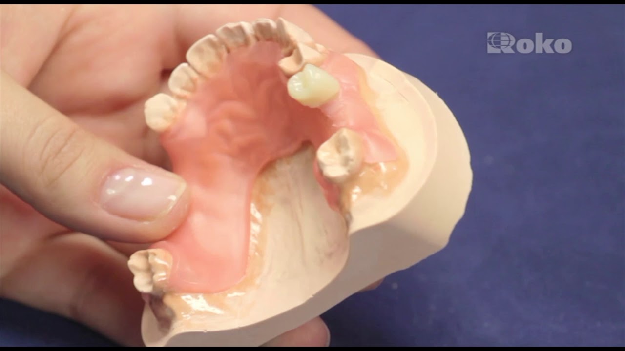 Acron Dentures  - Step by step manual by ROKO