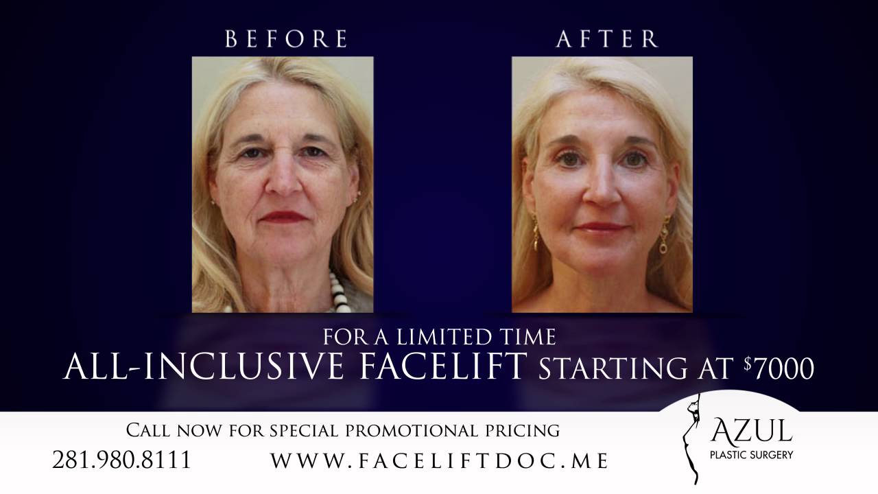 Houston Facelift Expert at Azul Plastic Surgery Sugar Land Woodlands TX