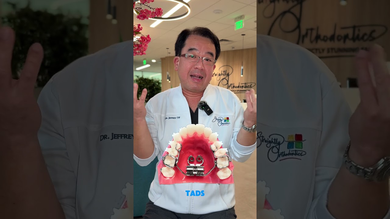 Expansion in adults with MARPE! 😁 #orthodontist #braces #marpe #expander #orthotips