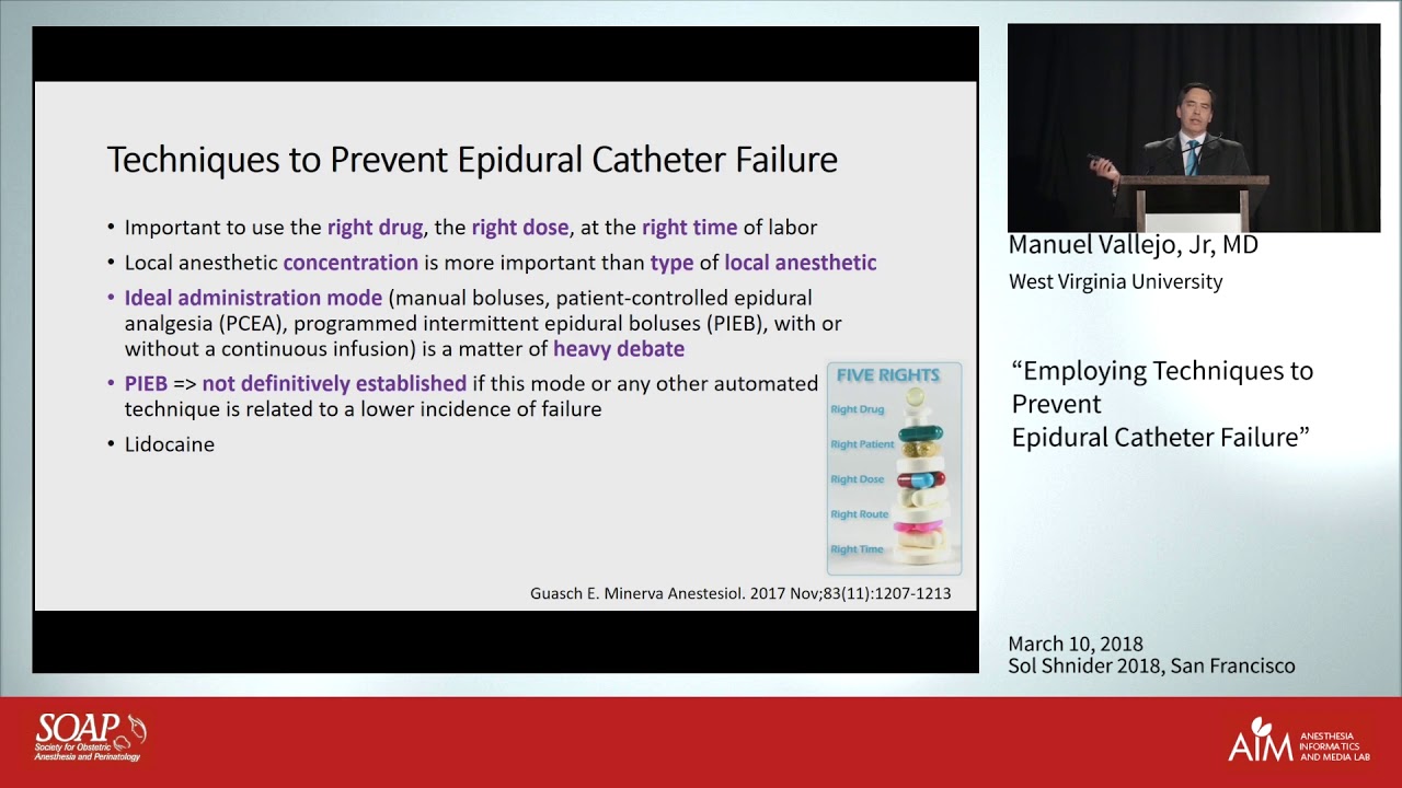 Employing Techniques to Prevent Epidural Catheter Failure 
- Manuel Vallejo, Jr., M.D., D.M.D.