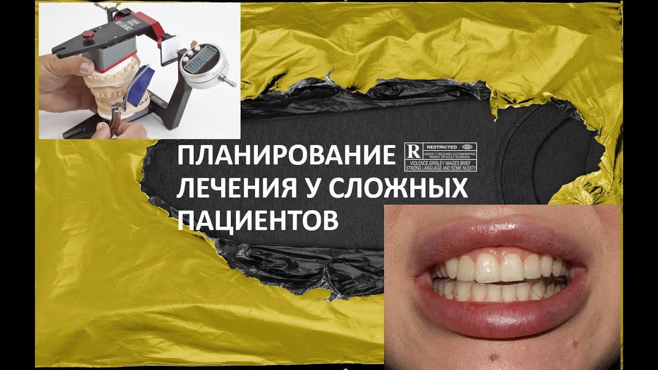 ПЛАНИРОВАНИЕ ЛЕЧЕНИЯ У СЛОЖНЫХ ПАЦИЕНТОВ