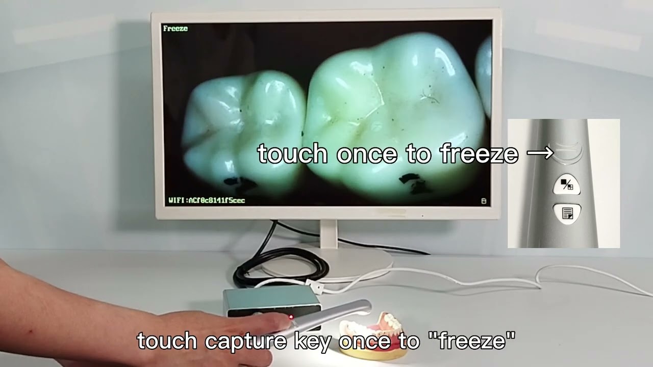 How do Aicreate A3S intraoral dental camera switch pictures?