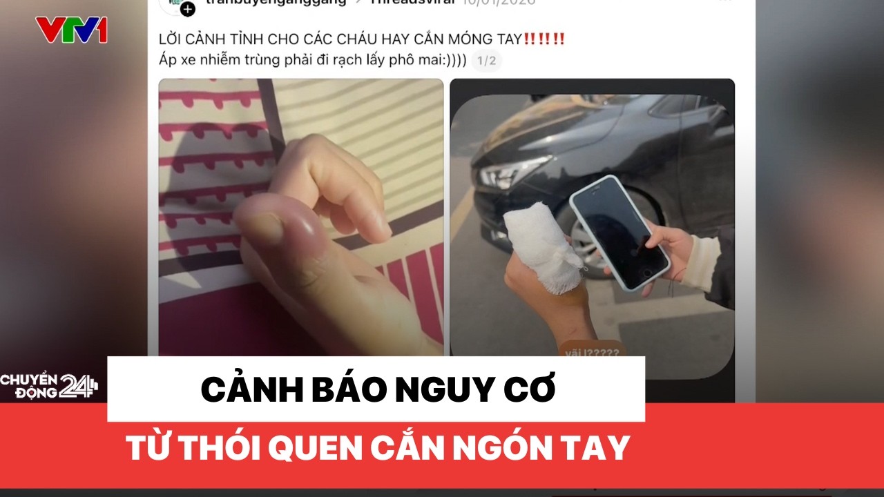 Cảnh báo nguy cơ từ thói quen cắn ngón tay