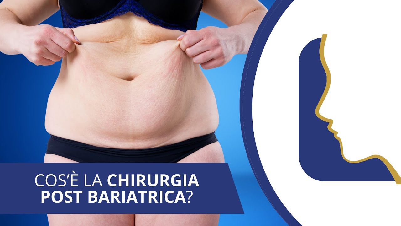 La Chirurgia post bariatrica