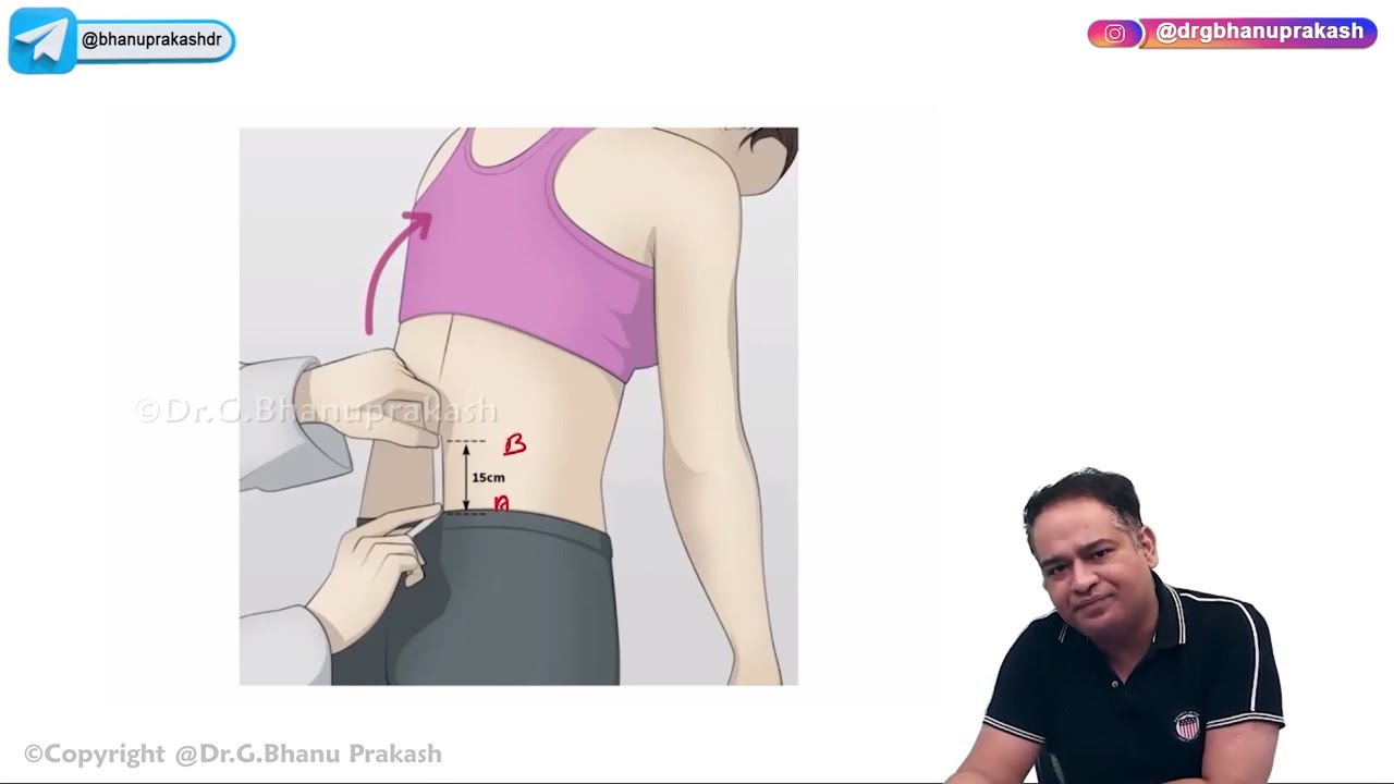 Ankylosing Spondylitis (Hindi) : Orthopedic Lectures