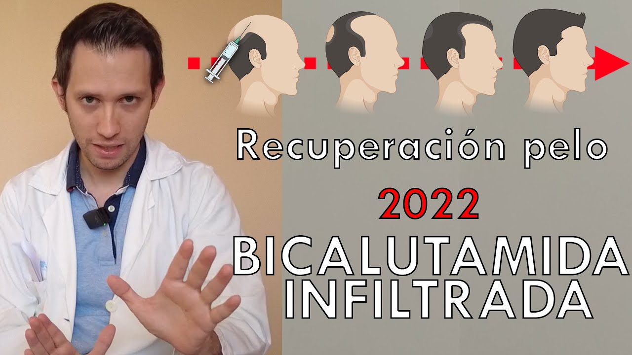 Recuperación pelo 2022 (NOVEDAD): bicalutamida infiltrada