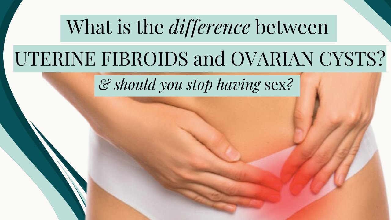 The difference between uterine fibroids & ovarian cysts with Dr. Samantha Pfeifer.