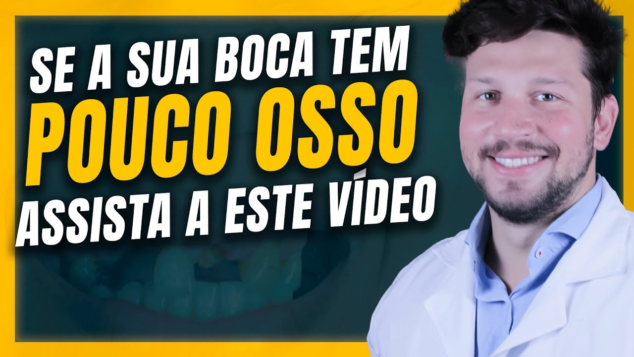 Dá para fazer IMPLANTE com POUCO OSSO?