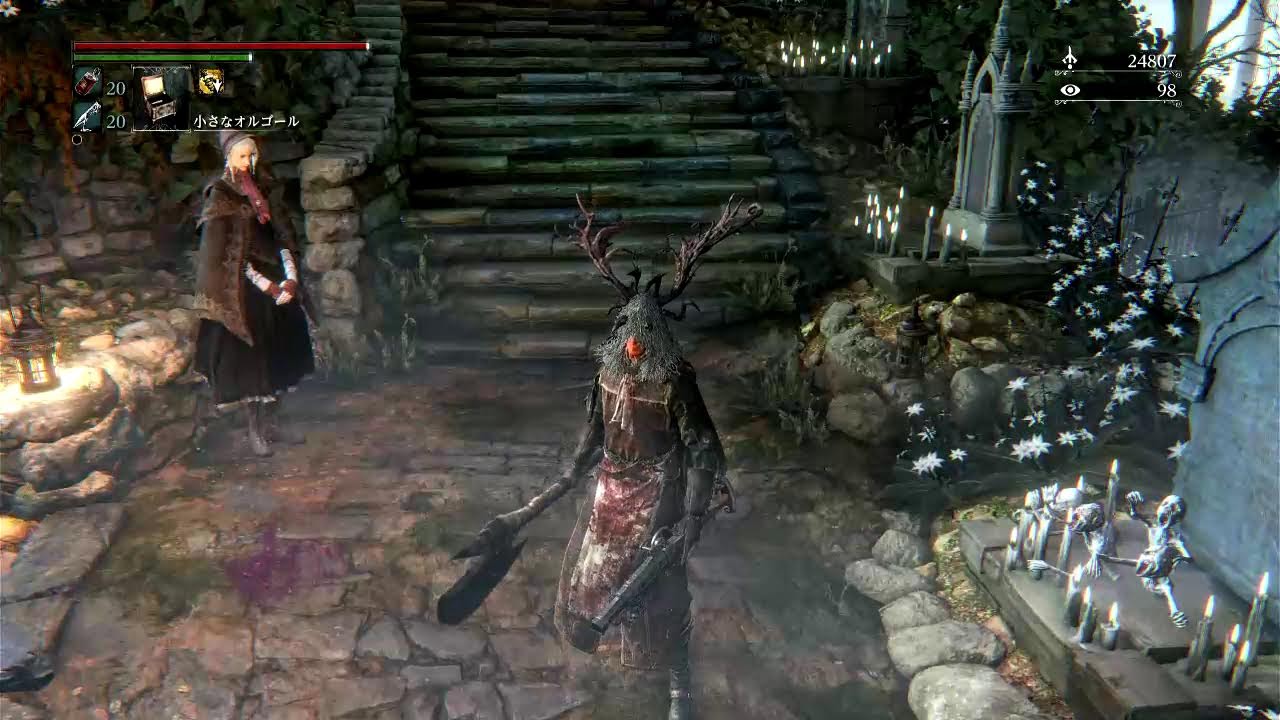 8年ぶり ⑤ Bloodborne ブラッドボーン　DLCやったことないから頑張る