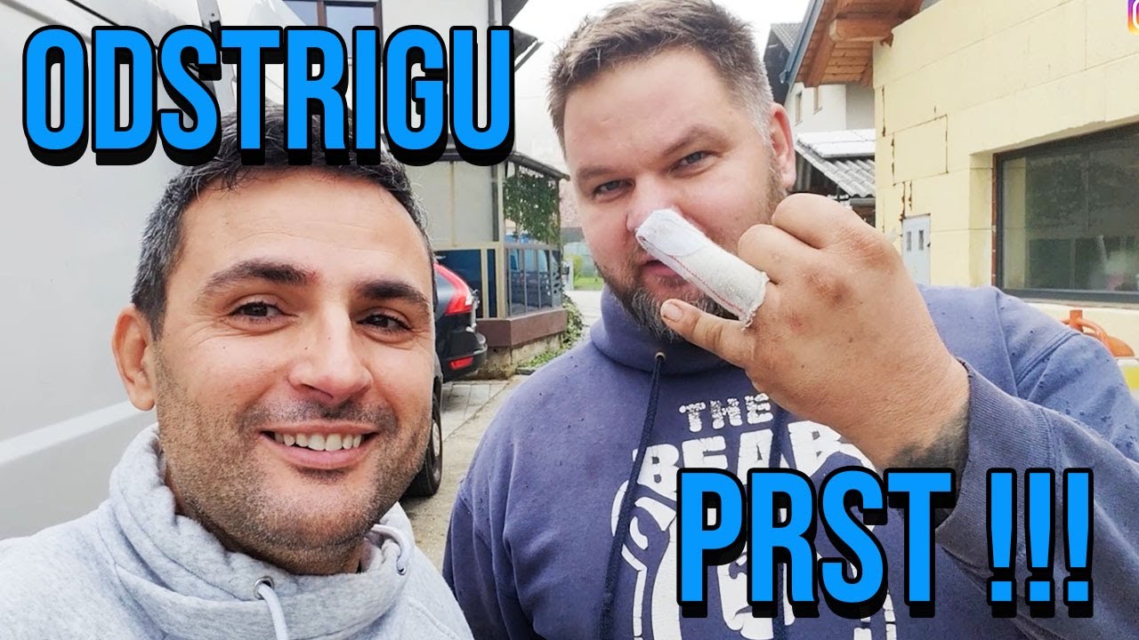 SKUBI SI JE SKRAJŠAU PRST!!!