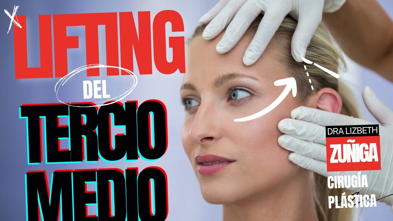 Lifting de TERCIO MEDIO: Levantar CEJAS, embellecer OJOS, levantar PÓMULOS ❤️ Dra Lizbeth Zuñiga
