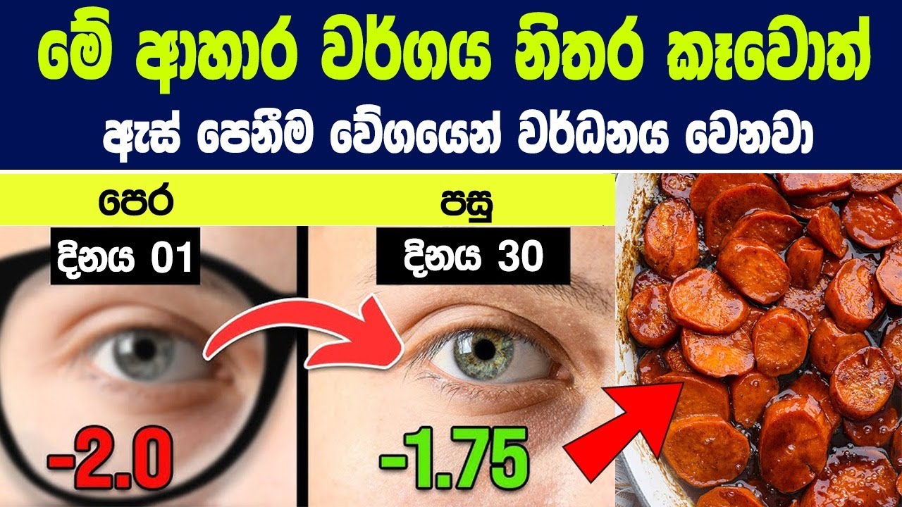 ඇස් වල පෙනීම අඩු වෙන්නේ මෙන්න මේ විටමින් එක හිග නිසයි - මේ ආහාර කන්න - පෙනීම වේගයෙන් වර්ධනය වෙනවා.
