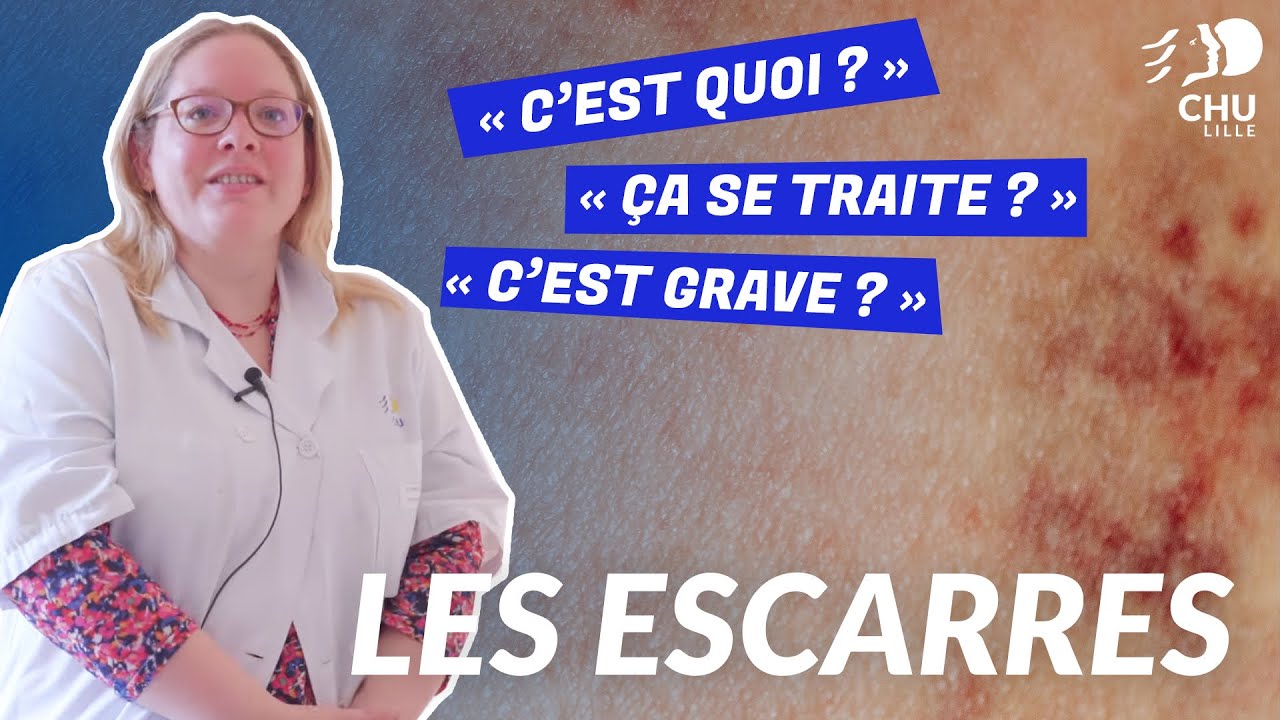 L'ulcère de la peau, le zona, en 5 questions