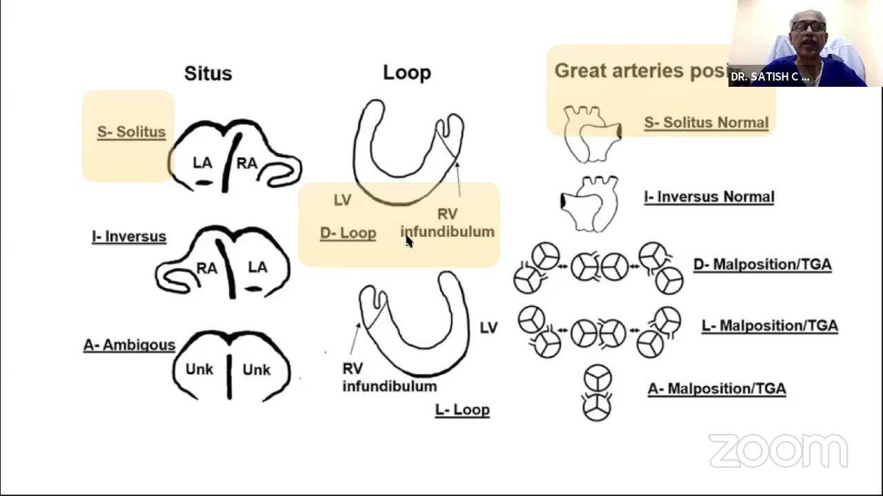 Lecture 06; Basics of Paediatric Echocardiography