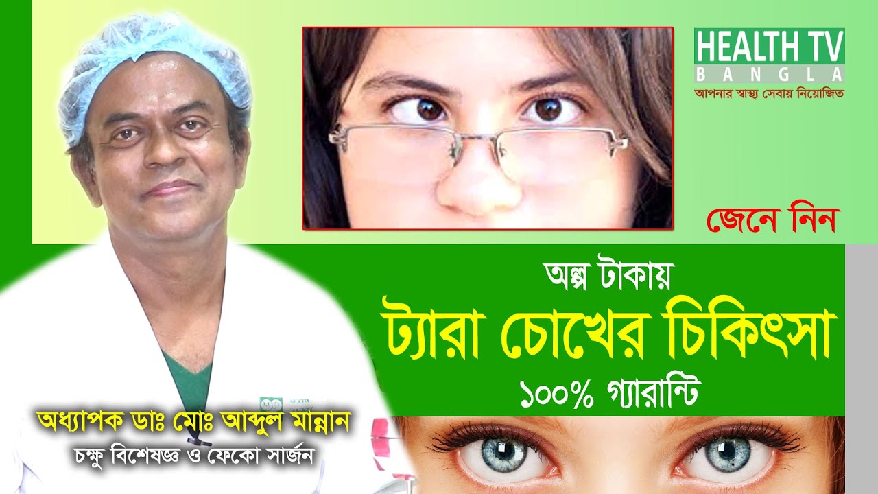 ট্যারা চোখের চিকিৎসা | Tera Chokher Chikitsha | Squint Eye Treatment Cost Bangla | Dr. Abdul Mannan