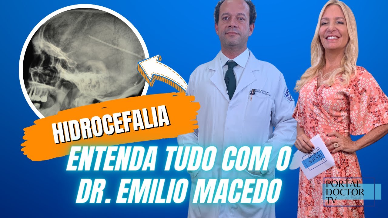 VOCÊ SABE O QUE É HIDROCEFALIA? - CAUSAS, SINAIS, SINTOMAS E TRATAMENTOS