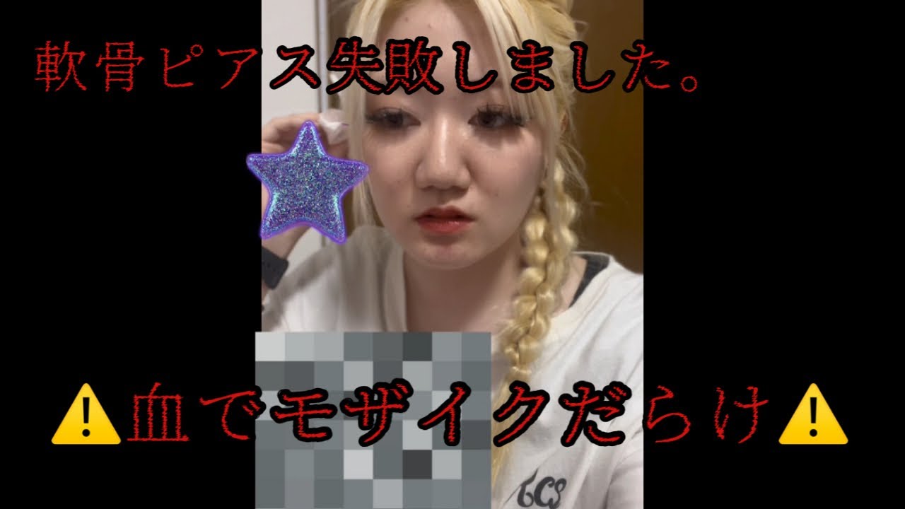 ⚠️閲覧注意⚠️ピアッサーで軟骨あけたら失敗しました。