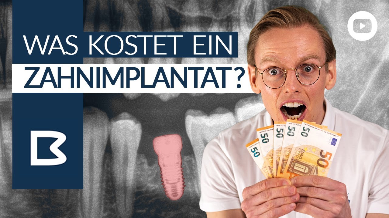 ZahnIMPLANTAT KOSTEN? Was muss ICH zahlen? Was zahlt die Krankenkasse? Alles GENAU erkl&auml;rt!