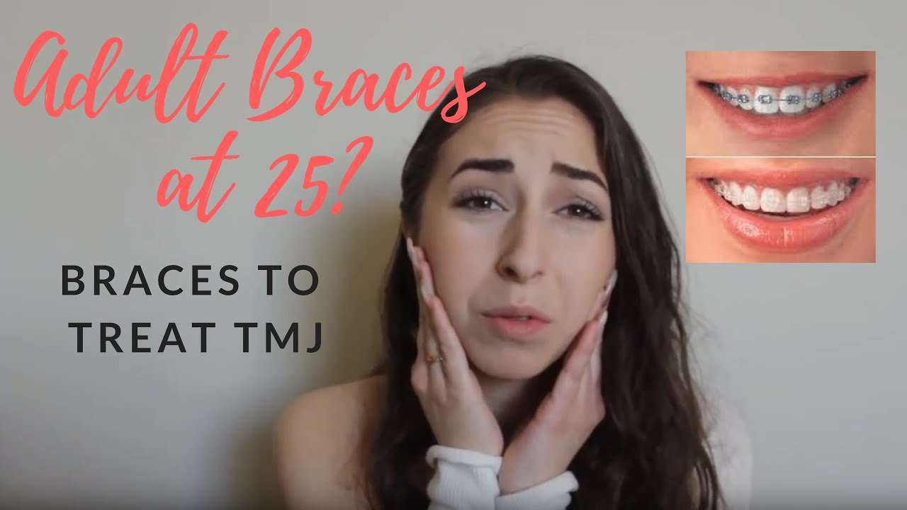 CERAMIC BRACES AT 25? // Day 1 Vlog | Adult Braces to Treat TMJ/TMJD