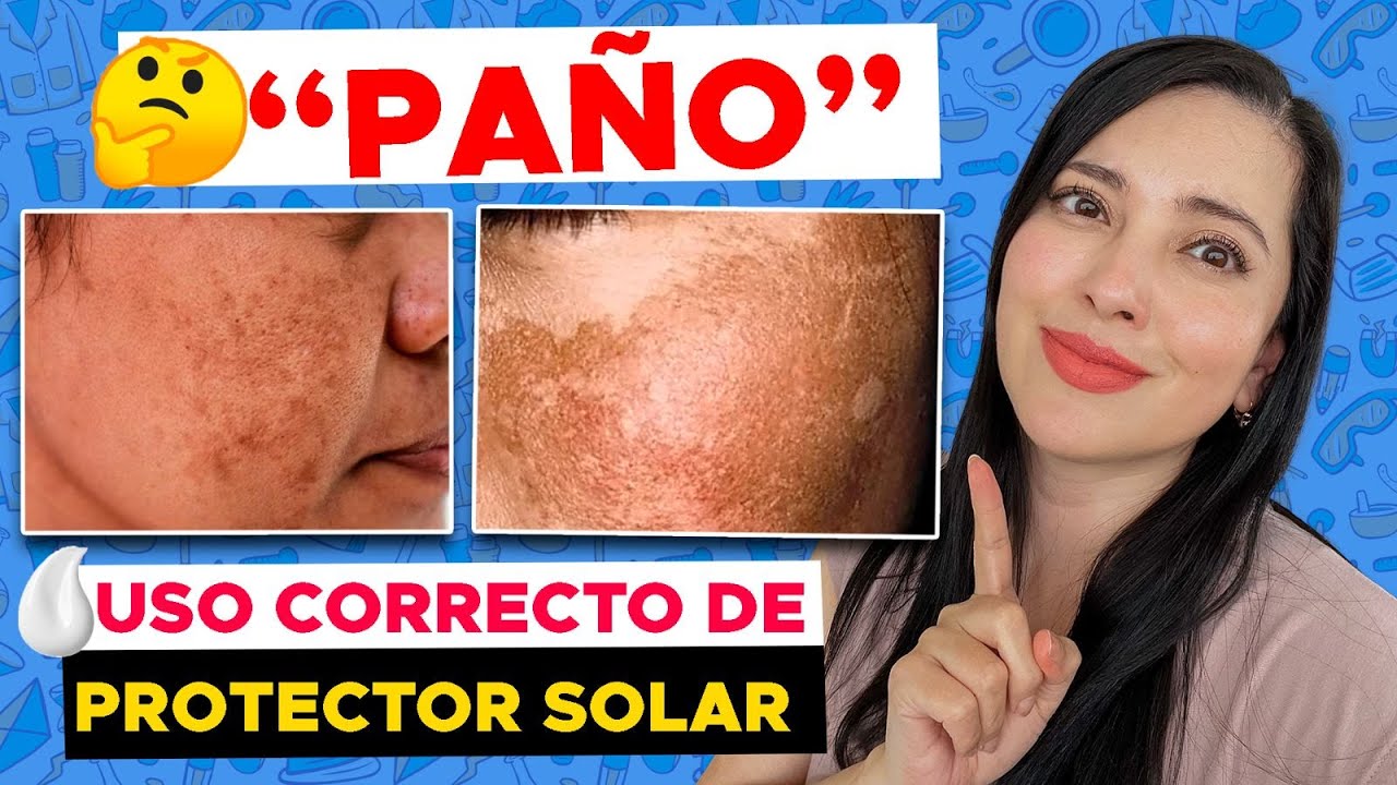 SI TIENES MANCHAS, ASI DEBES USAR EL PROTECTOR SOLAR