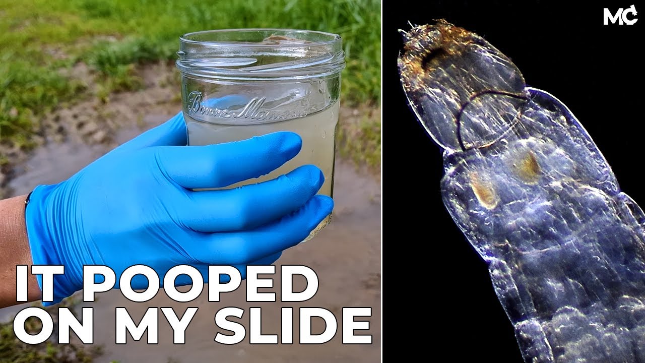Dirty Water Under Microscope: Big Rotifers Love To Jump Scare Me  |Magnificent Puddles #1