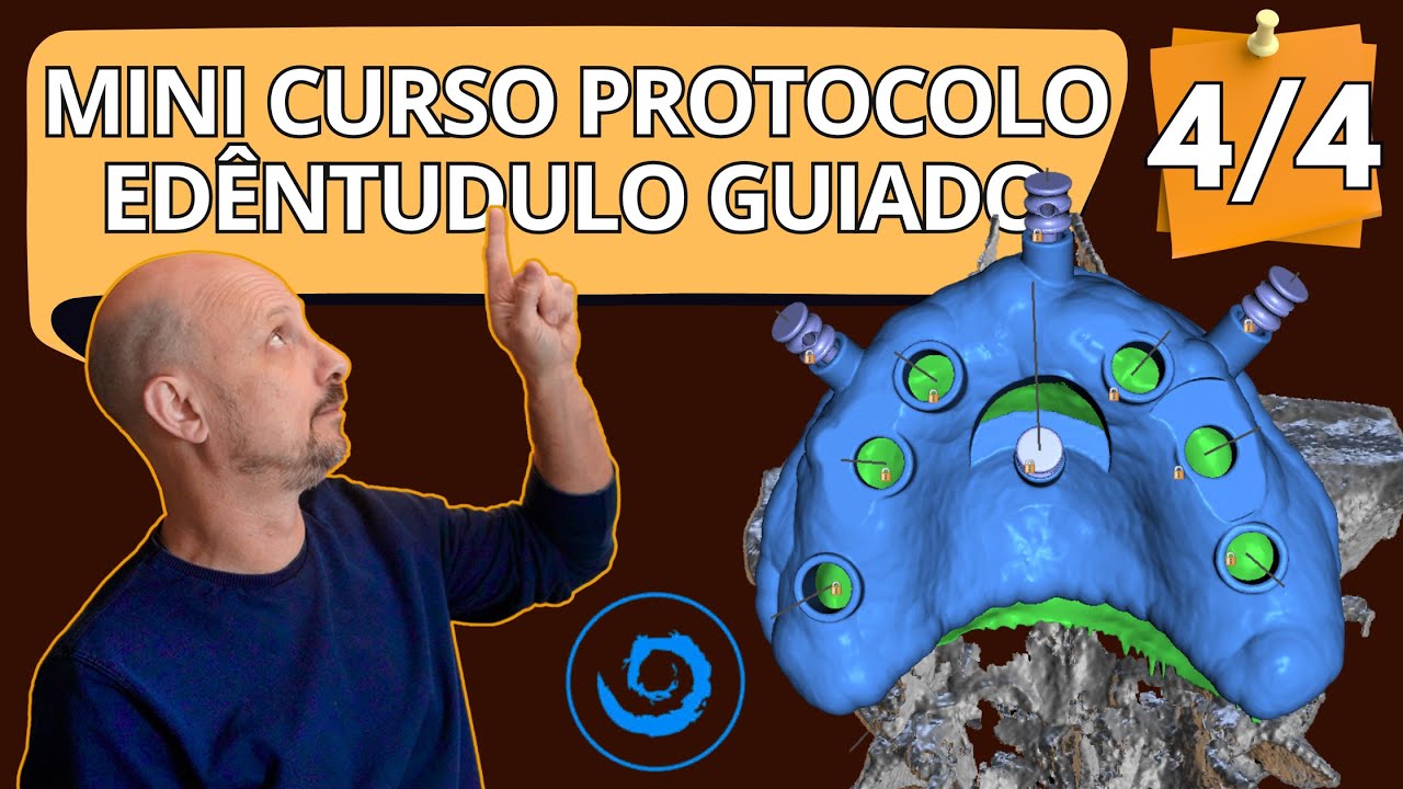 Mini curso completo:  Como desenhar um  guia cirúrgico para edêntulo total no BlueSkyBio - 4/4