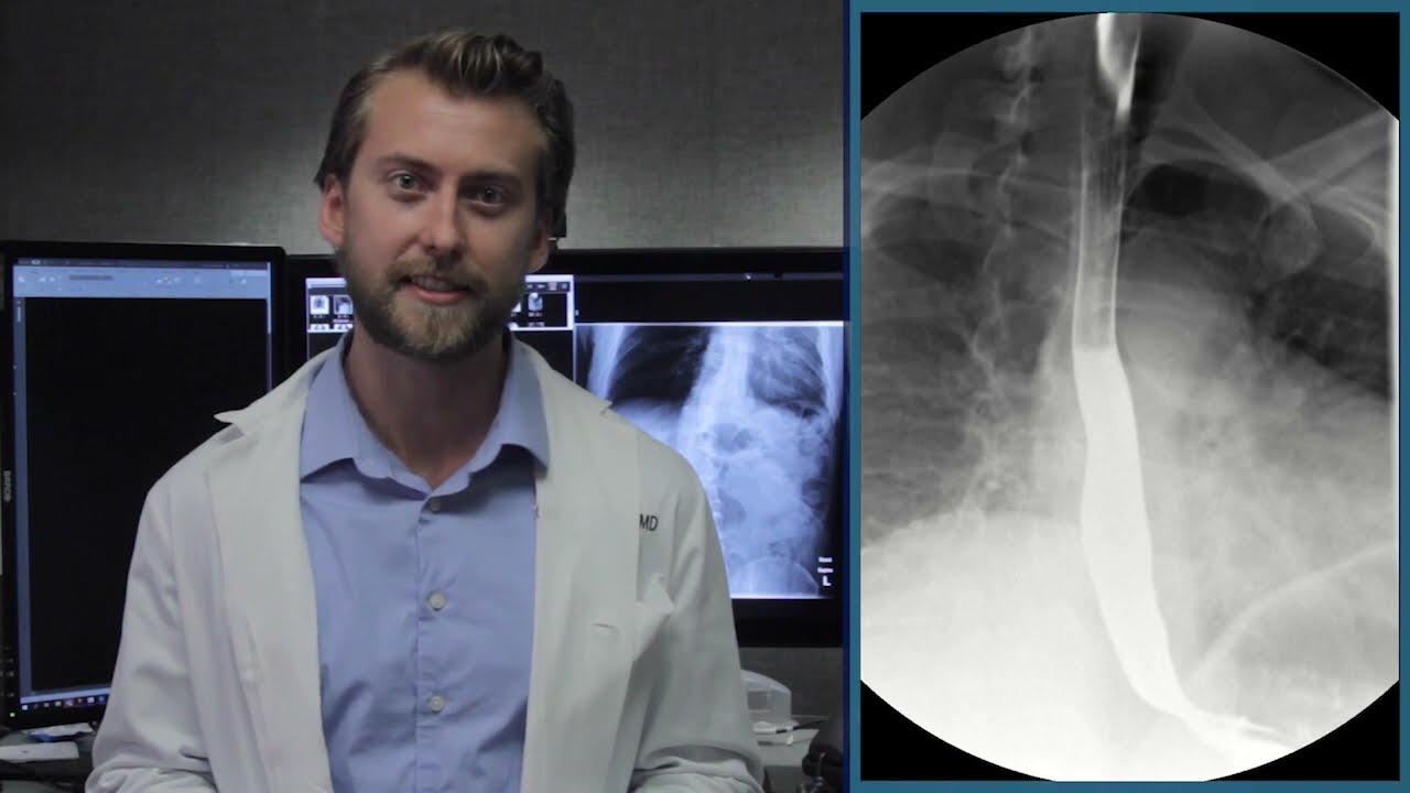 Upper GI Series Patient Education Video