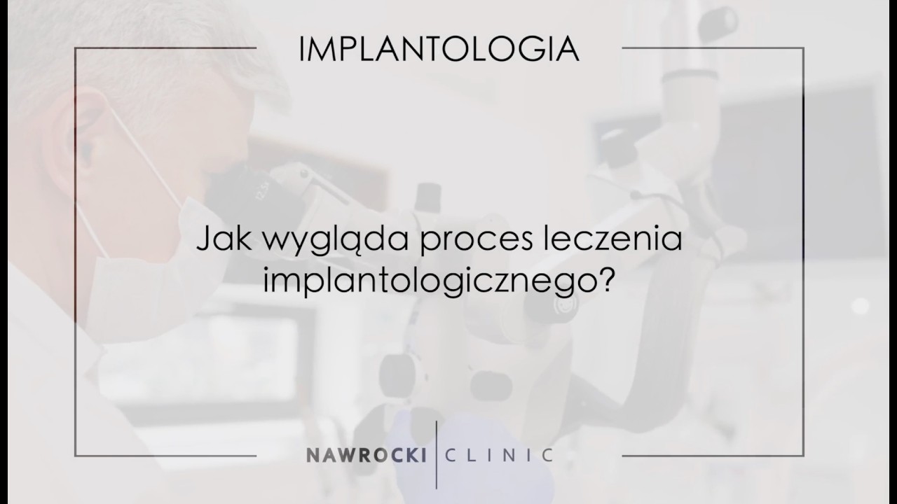 Implantologia - Jak wygląda proces leczenia implantologicznego?