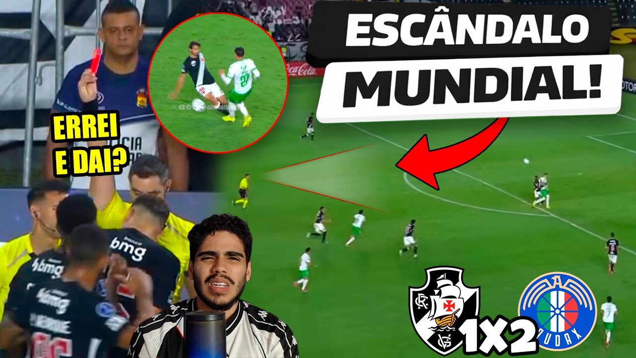 🚨🚨 ESCANADALO MUNDIAL EXPOSTO! VASCO E GARFADO DE FORMA BIZARRA! POS JOGO VASCO X AUDAX