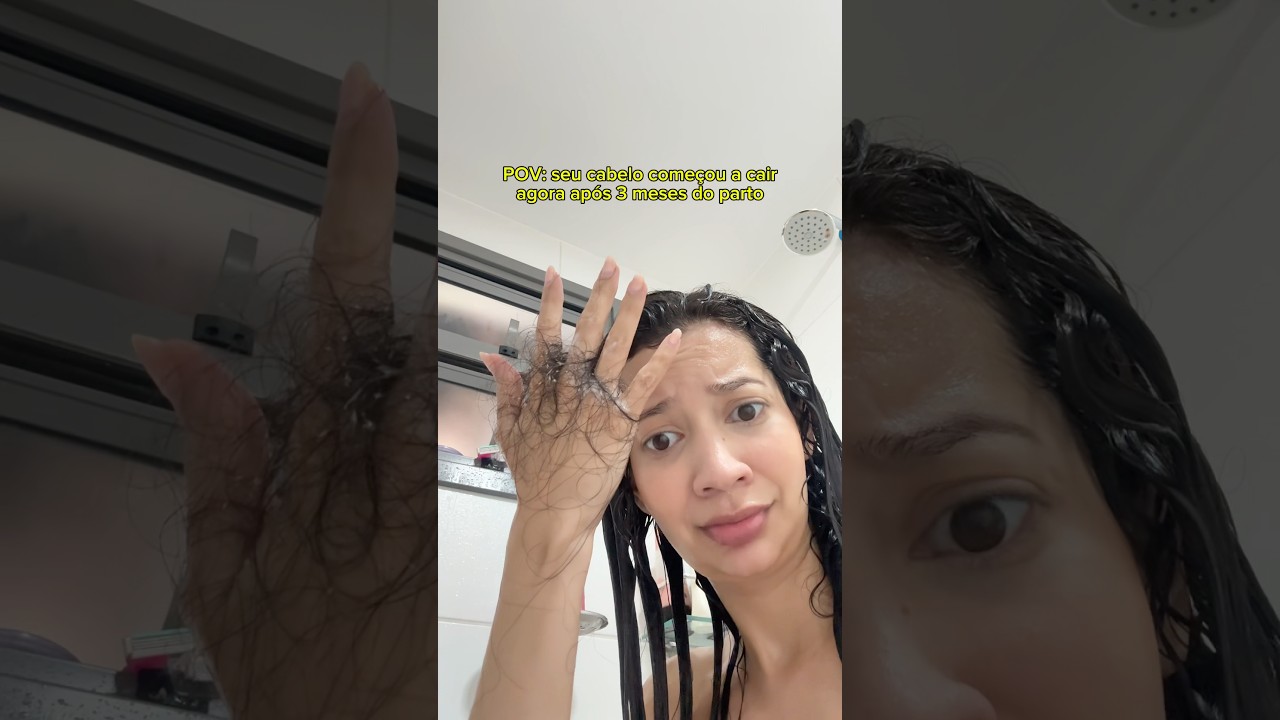 Meu cabelo t&aacute; caindo muiiiito p&oacute;s parto 😭😱😮&zwj;💨