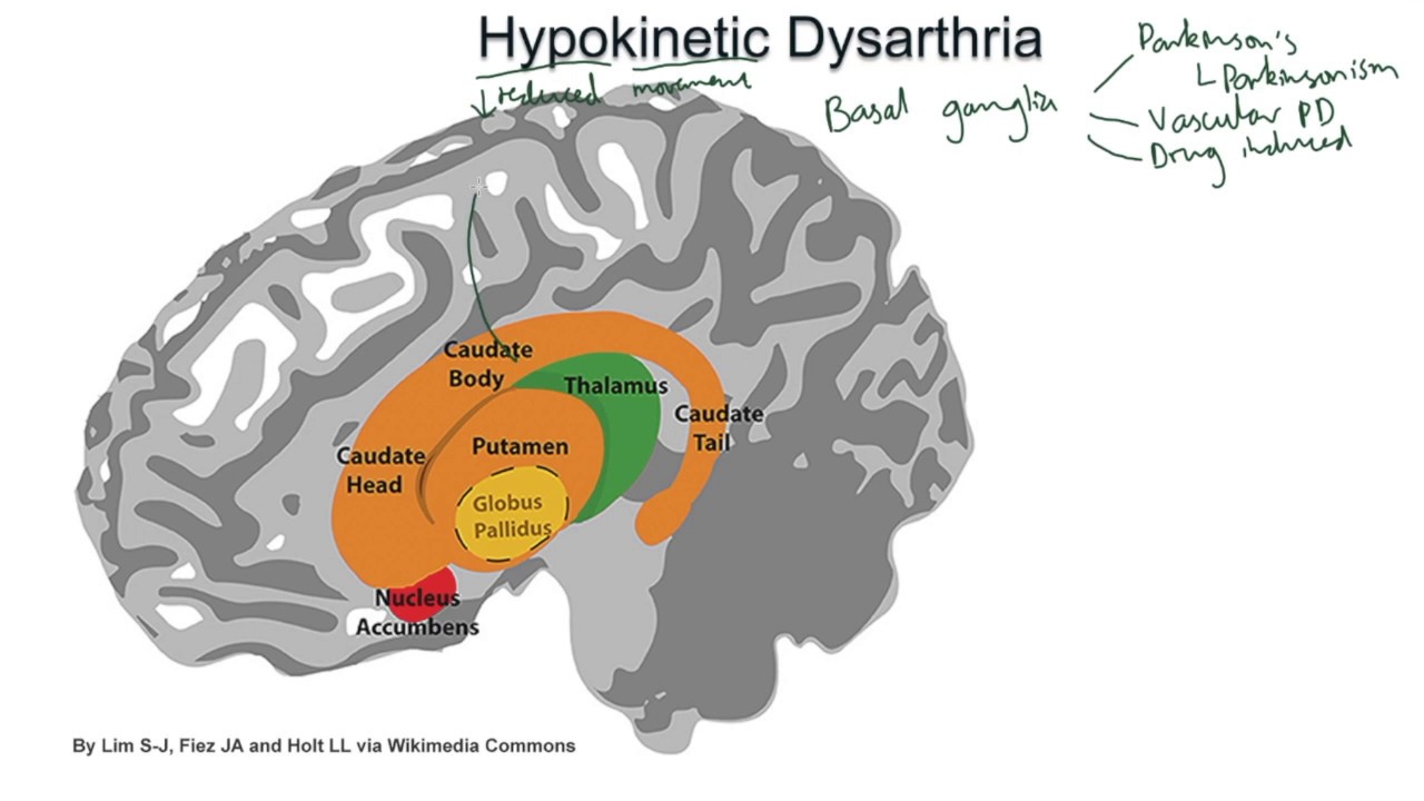 Hypokinetic Dysarthria - examples and tutorial