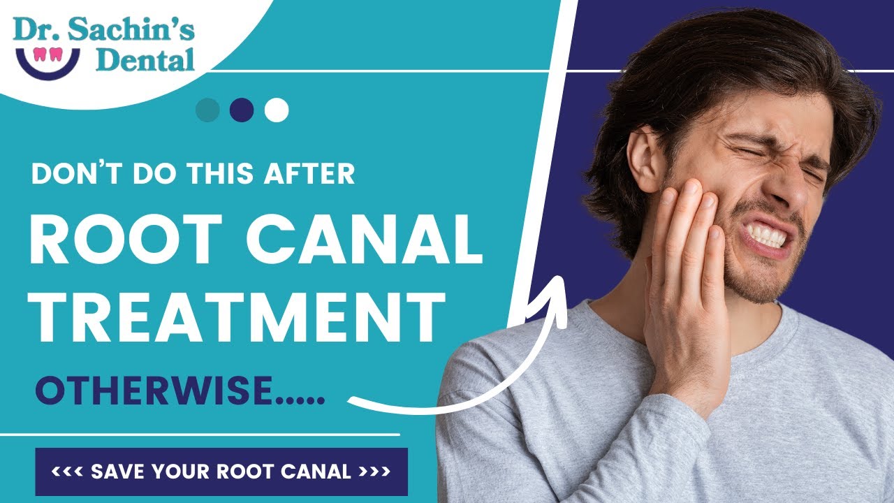 Dos and Don'ts After Root Canal Treatment &ndash; 5 Tips #rct