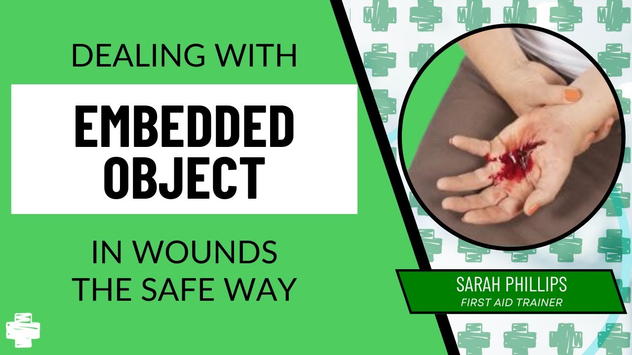 Treating Embedded Objects and Amputations - Step-by-Step Guide