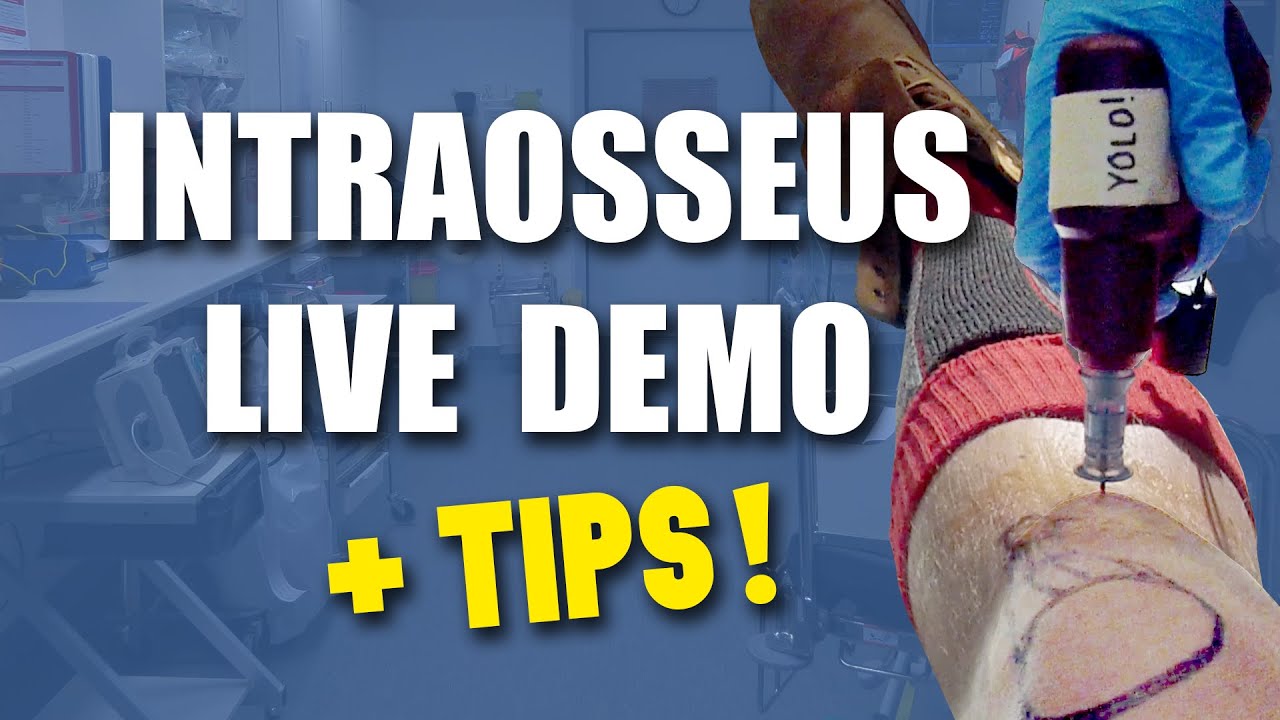 Intraosseos Live Insertion + Tips