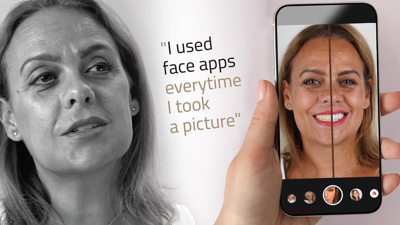 A Smile Makeover in Turkey - No more Face Apps!