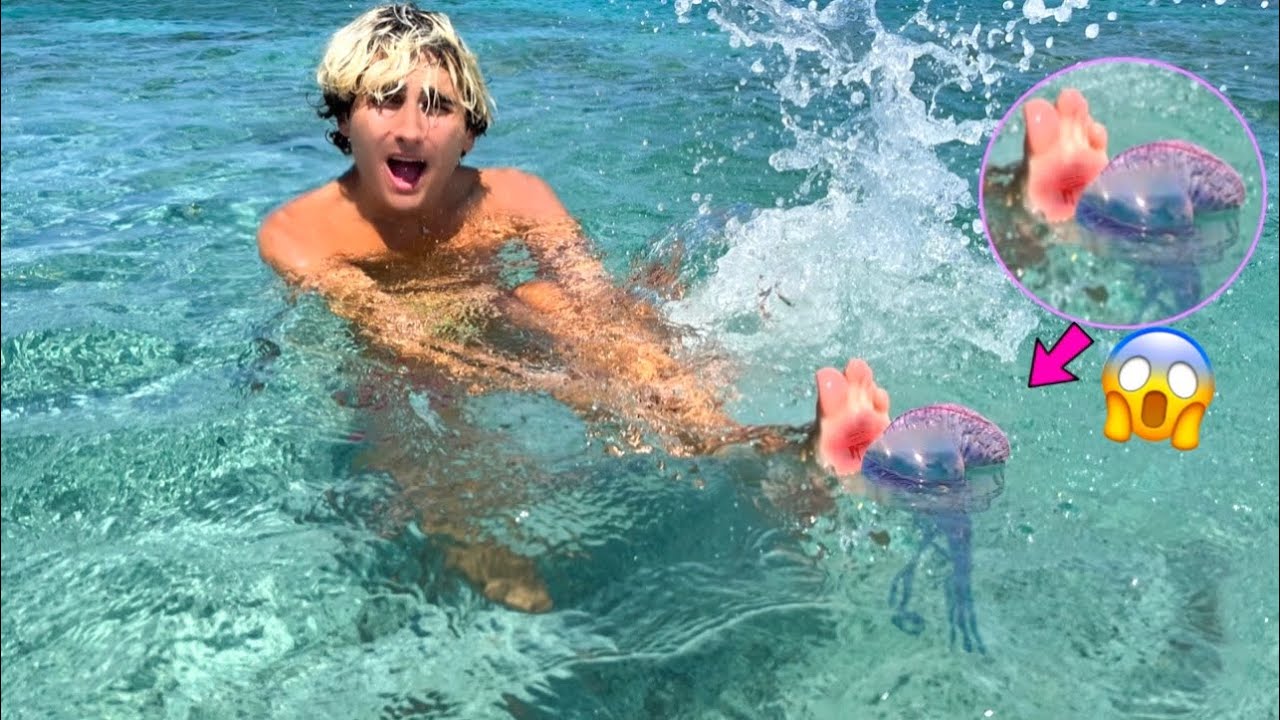 VINCI È STATO PUNTO DA UNA MEDUSA AL MARE!!! 😱🌊 *medusa gigante*