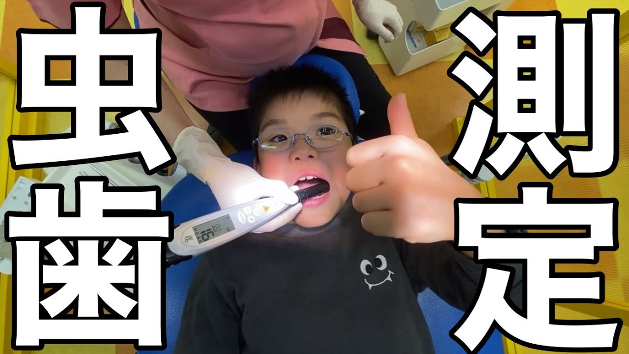 虫歯の酷さを測定してみた。子供が嫌がらない簡単に虫歯を測定する方法