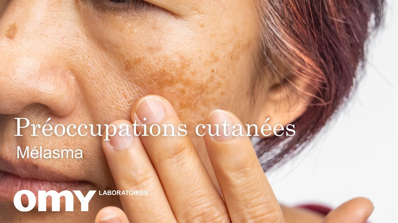 Qu'est-ce que le m&eacute;lasma? | Omy Laboratoires