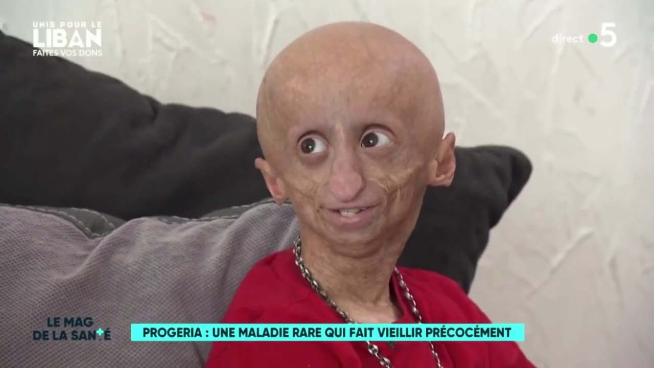 Reportage France 5 sur Rania qui a la maladie de progeria