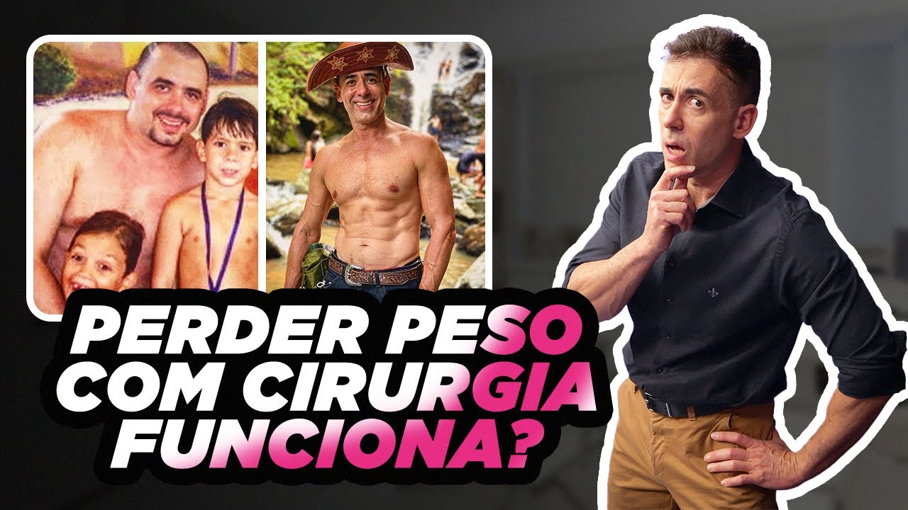CIRURGIA PARA EMAGRECER RÁPIDO | Dr Dayan Siebra