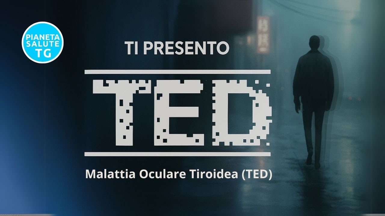 👁 Malattia Oculare Tiroidea (TED): Cos'è, Sintomi e Come Affrontarla