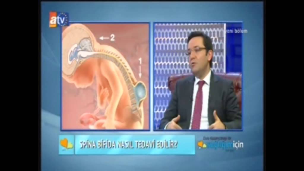 ÇOCUKLARDA AÇIK OMURGA HASTALIĞI (SPİNA BİFİDA)
