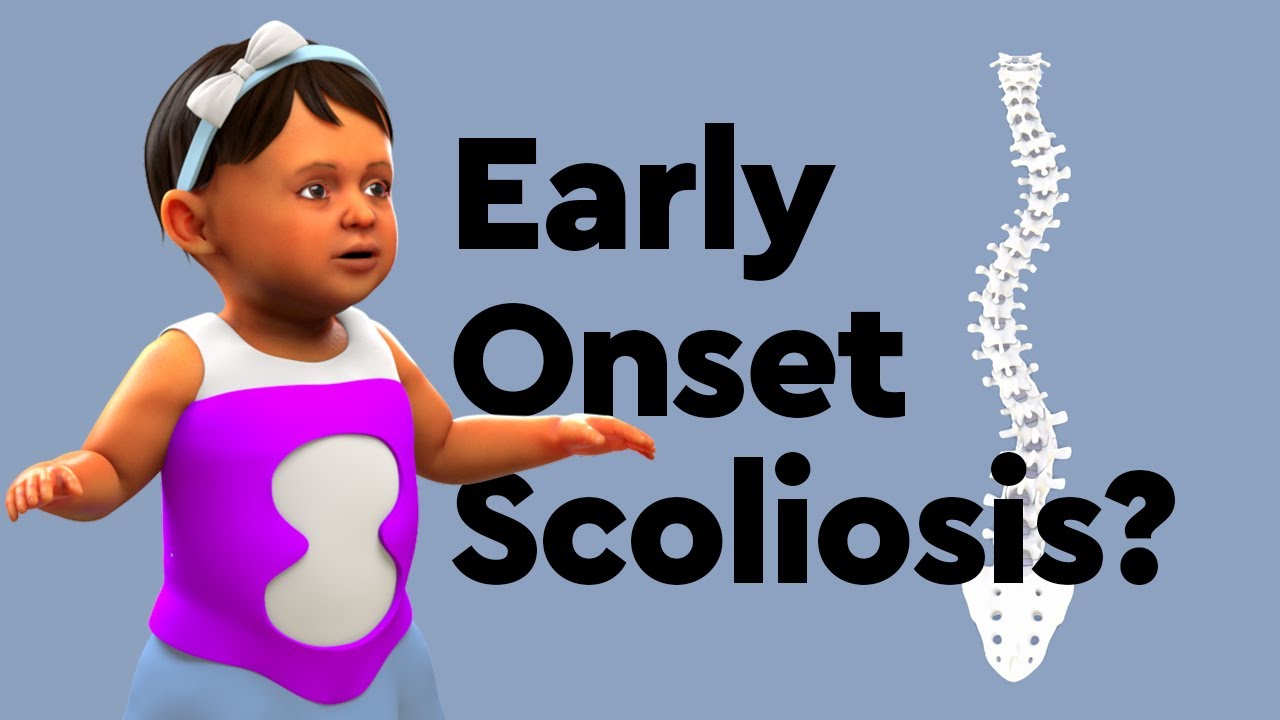 What is Early Onset Scoliosis and How is it Treated?
