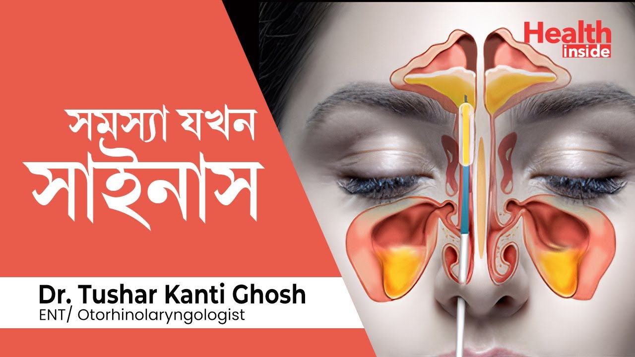 সাইনাস কি, সাইনাস কেন হয় এবং সাইনাসের ঘরোয়া চিকিৎসা | What is sinus? sinus home remedy in Bengali